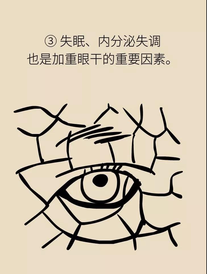 干眼原因三